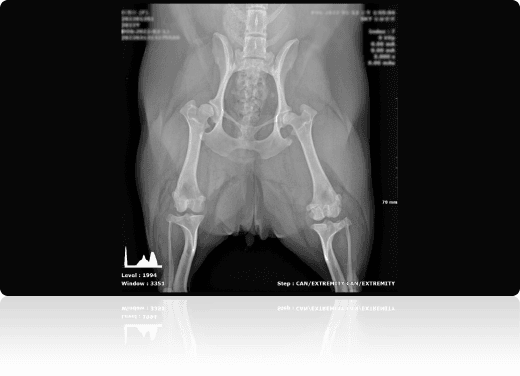근골격계 분석 예시 원본 X-ray