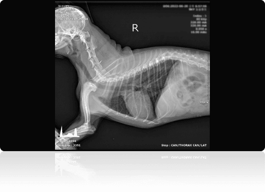 흉부 분석 예시 원본 X-ray